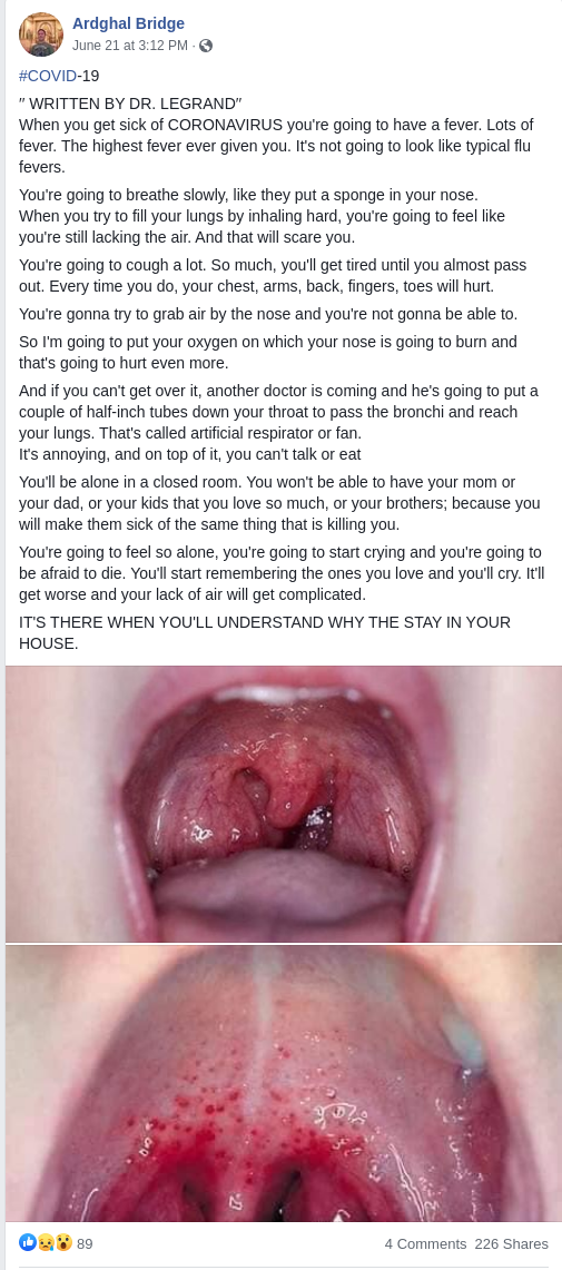 screenshot_misleading_photos_covid_throat-4581493
